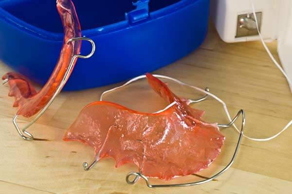 Orthodontic-Retainer